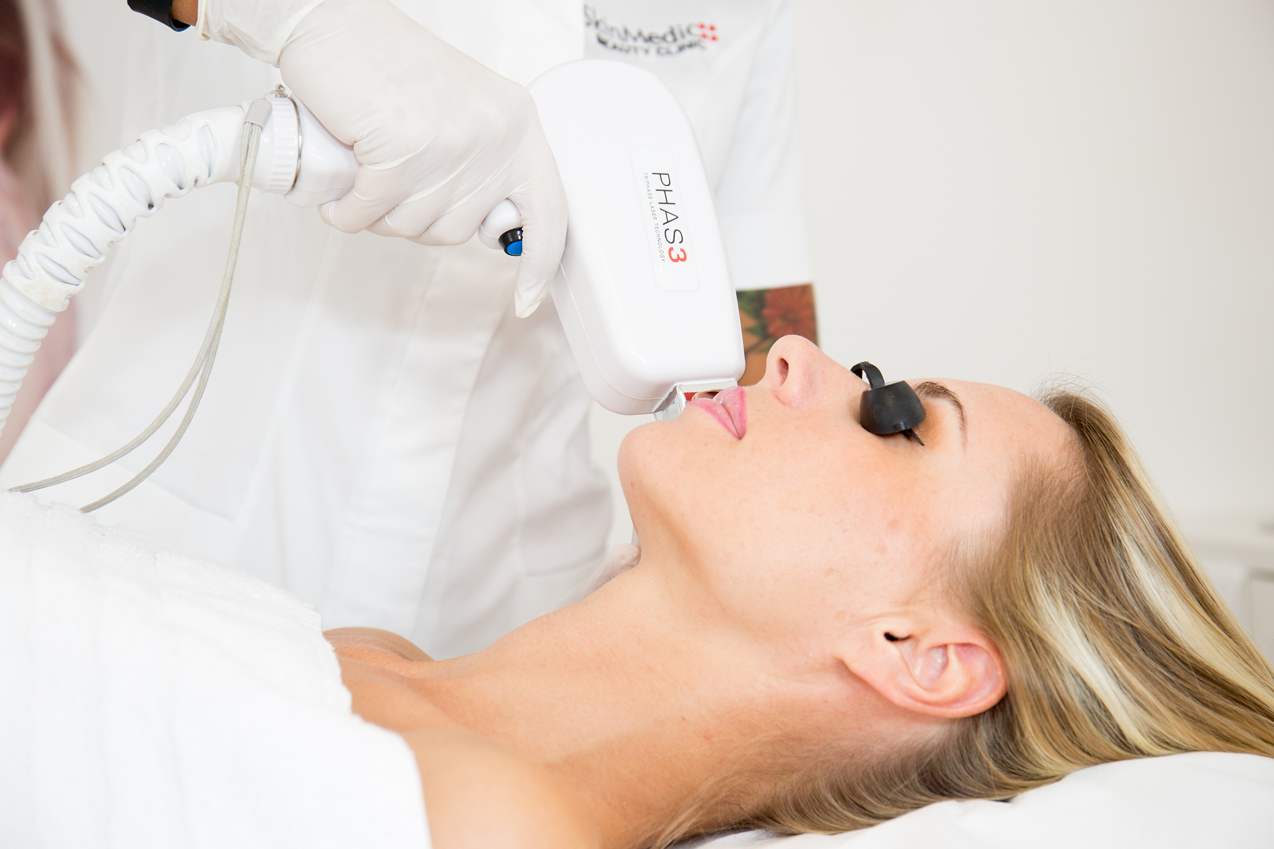epilazione laser viso pinerolo